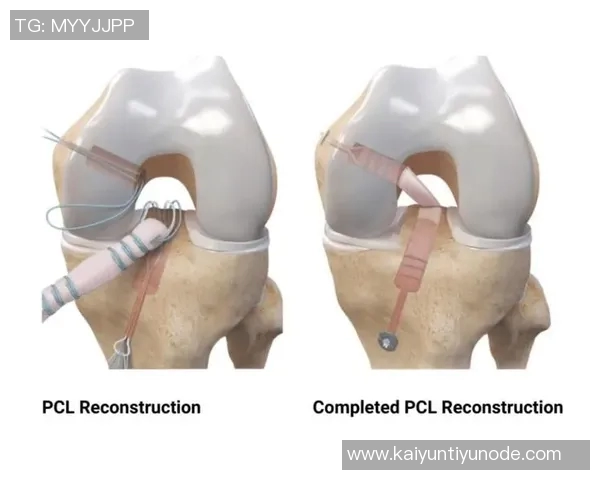 麦迪逊透露十字韧带撕裂恢复进展期待明年四月重返赛场